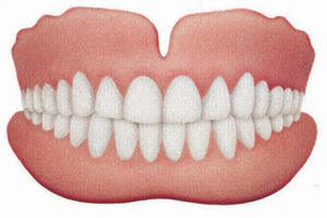 Dentures Removable