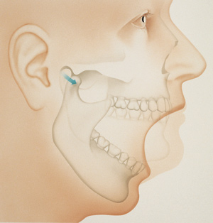 Faceand Joint