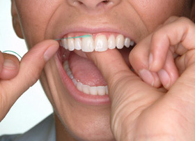 When the floss reaches the gum line, curve it into a C shape against one tooth. Gently slide it into the space between the gum and the tooth.